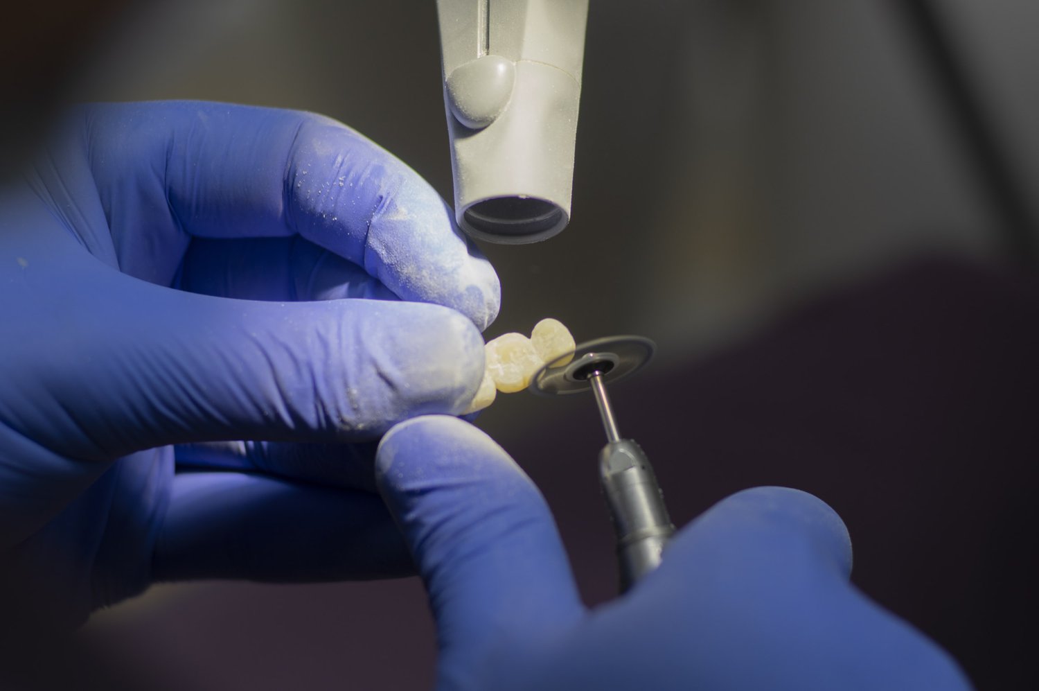 A dentist wearing blue gloves uses a dental tool to shape or polish a set of dental crowns or veneers under a magnifying scope - Dental Lab in Atlanta A dentist wearing blue gloves uses a dental tool to shape or polish a set of dental crowns or veneers under a magnifying scope - Dental Lab in Atlanta